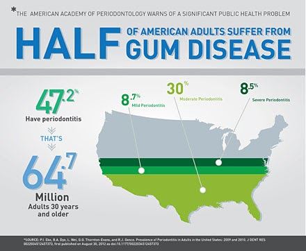 American gum disease infographic